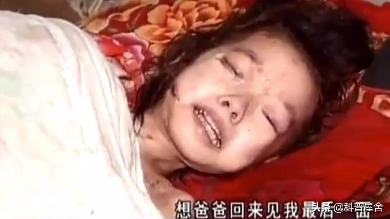 四川十岁女孩患怪病近况,四川十岁女孩长蛆后续