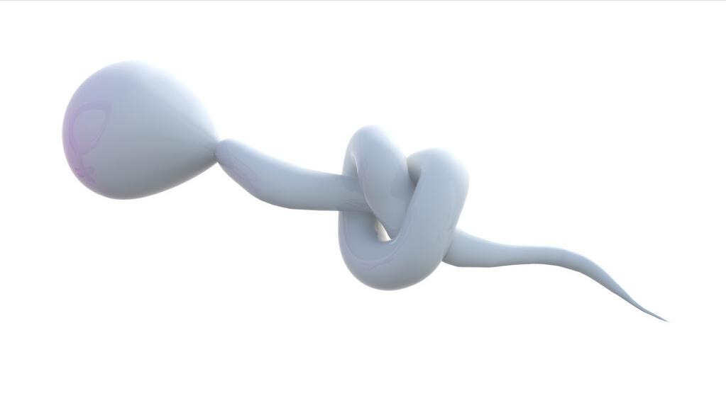 男性解脲支原体阳性影响备孕吗,夫妻有支原体阳性会影响怀孕吗