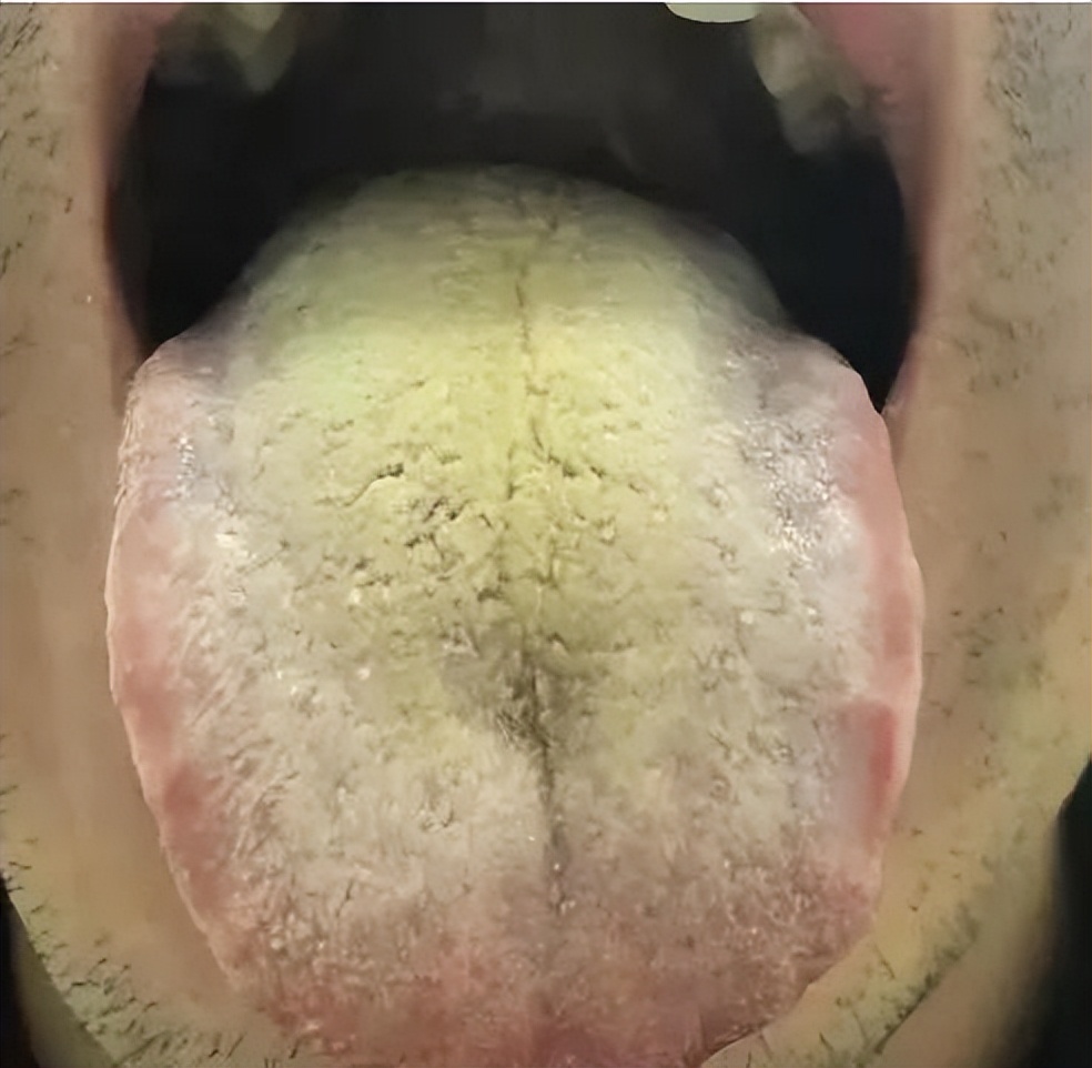 晚上睡觉经常醒？醒后入睡困难？医生告诉你原因，教你绝招搞定它