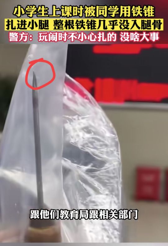男孩被同学铁锥扎腿,小学生用铅笔扎伤同学可以报警吗