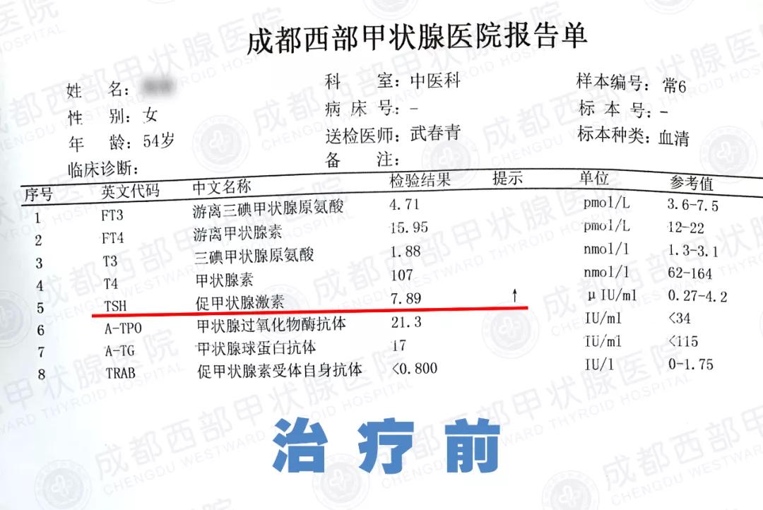 甲减压气喘不上来气怎么办,甲减感觉压迫气管怎么办