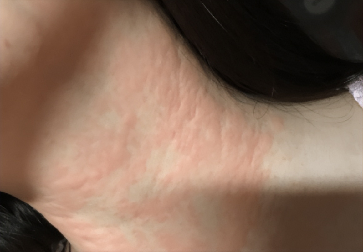 一饿就心慌手抖想吃甜的,一饿就心慌手抖但没查出低血糖