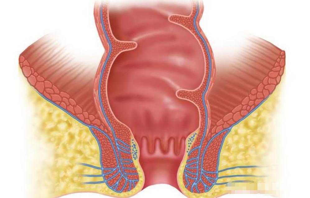 您有“洗屁股”的习惯吗？医生：经常清洗肛门，或能预防4种疾病