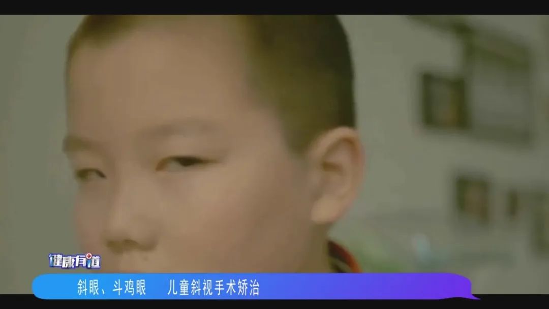 徐州儿童医院眼科斜视,徐州治疗儿童斜视哪个医院好