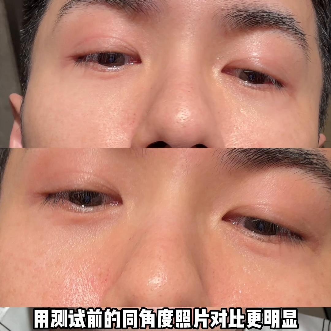 咖啡渣去黑眼圈的调配,咖啡渣椰子油去黑眼圈