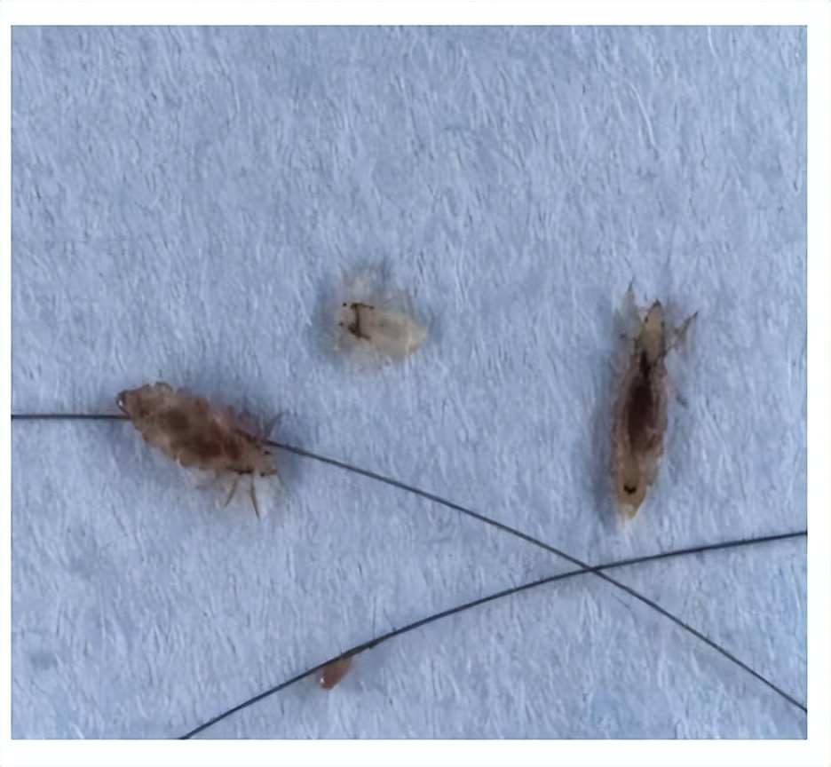 吸血臭虫和蜱虫一样么,咬人吸血的臭虫是什么虫