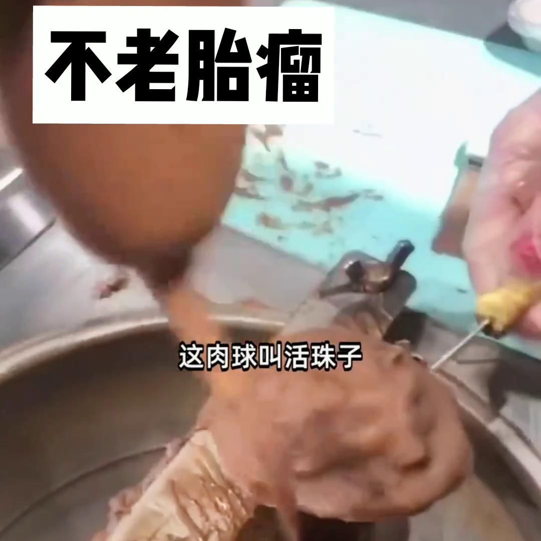 ?不老胎瘤@DOU+小助手