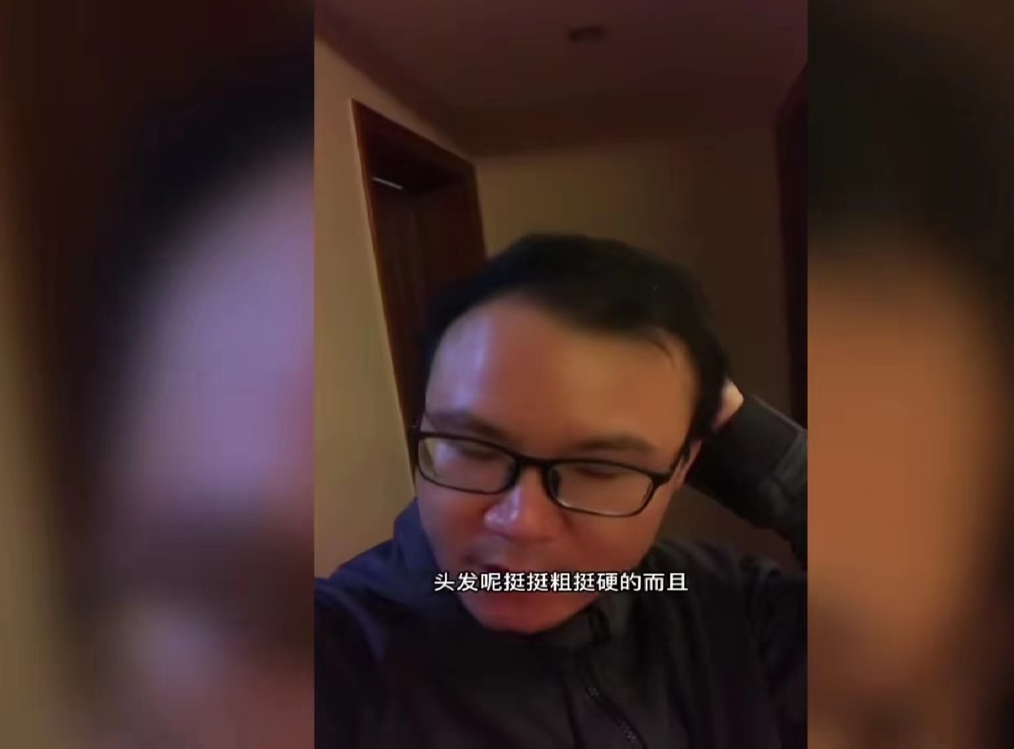 杭州一秃顶男子现身说法,治疗秃顶的手段竟是不用洗发水?