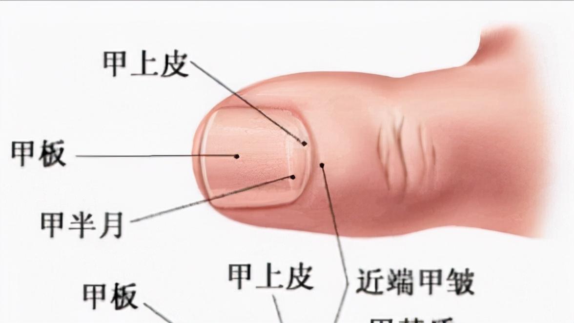 指甲往肉里长怎么办,指甲老往肉里钻