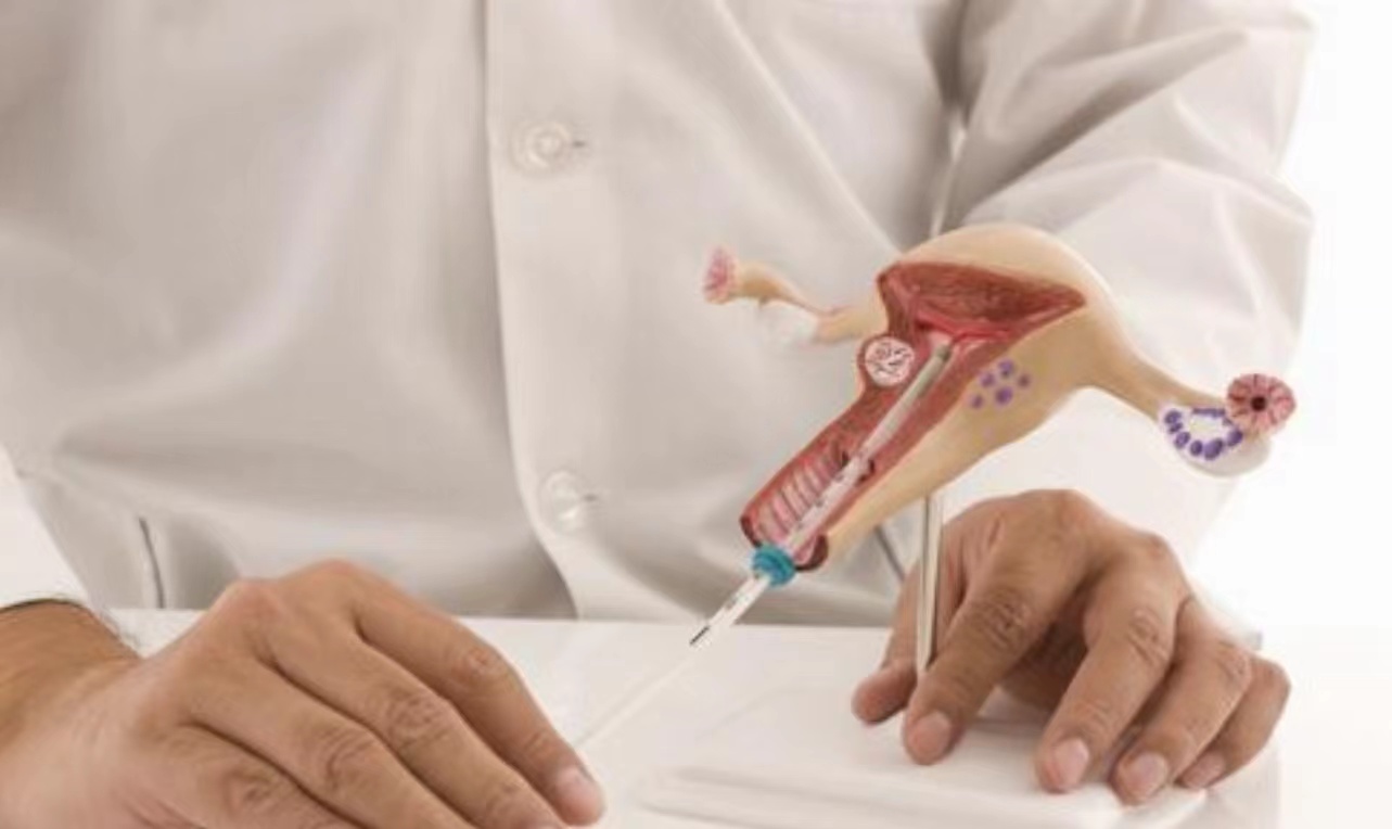 上环对女性有哪些危害,上环对身体有哪些影响和危害