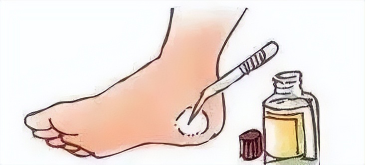 皮擦破了是撕下来好还是留着好,皮擦破了一大块需要包扎吗