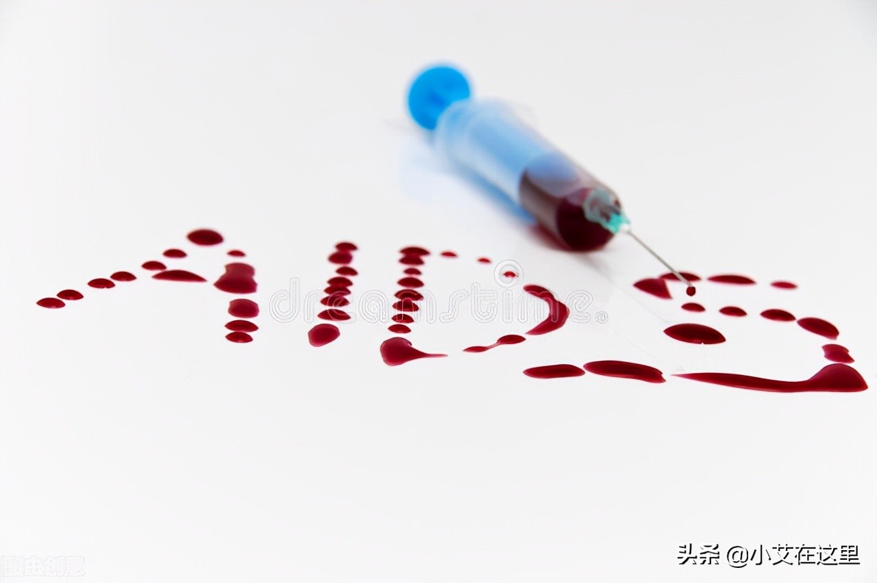 hiv感染风险评估,hiv感染高危因素