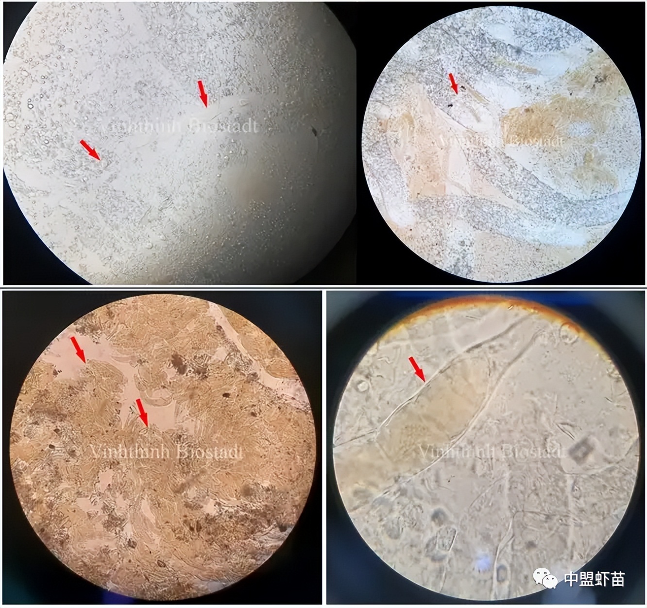 这种虾病，对虾产业产生深远影响！养殖大神揭露该病的今生前世！