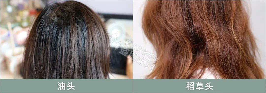 洗发水越用越不去屑,洗发水越用越掉发