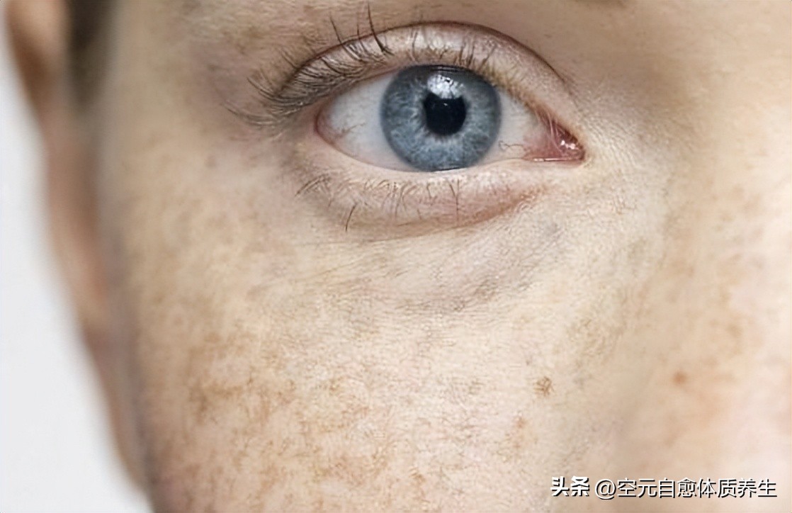 面色发黄气血不足怎么锻炼,脸色蜡黄怎么补气血