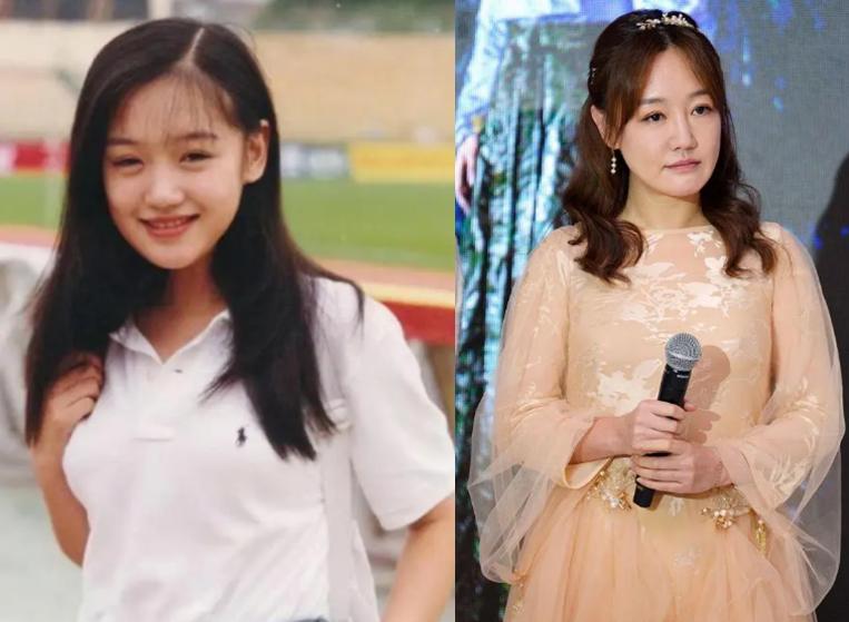 最近脸僵硬的女星,脸部变僵硬的女明星