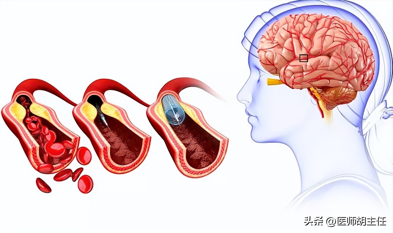 中老年人补充叶酸哪种牌子好,中老年白发补充叶酸有用吗