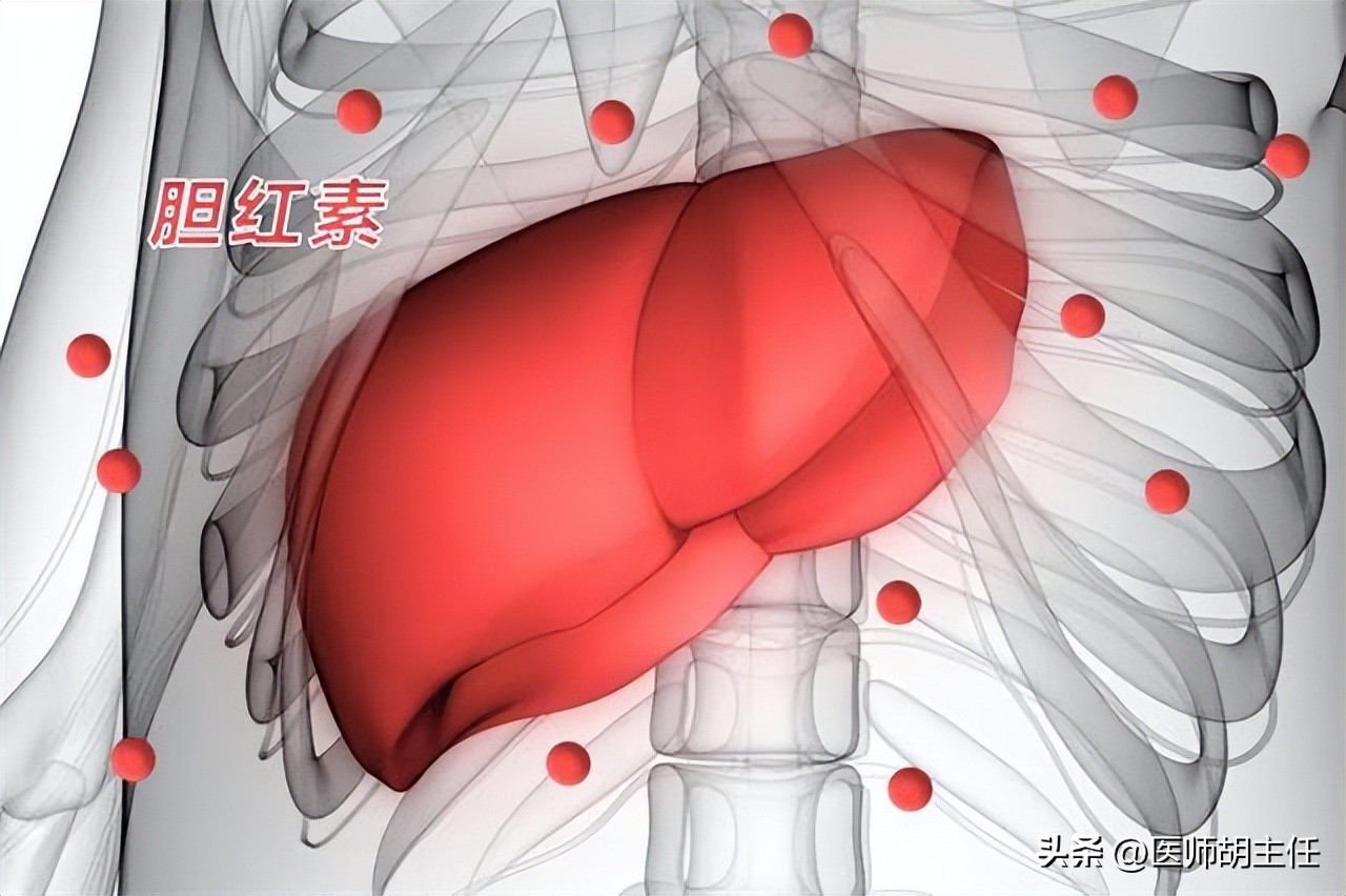 体检发现胆红素高是怎么回事,体检胆红素高怎么快速降下来