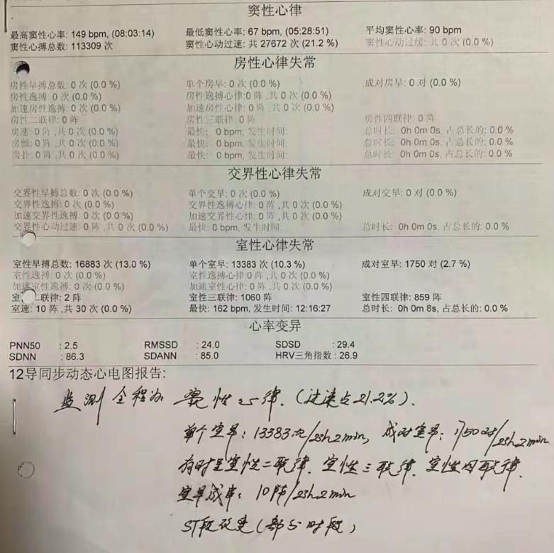 妈妈老是心慌吃什么药,妈妈心律不齐的原因及治疗方法