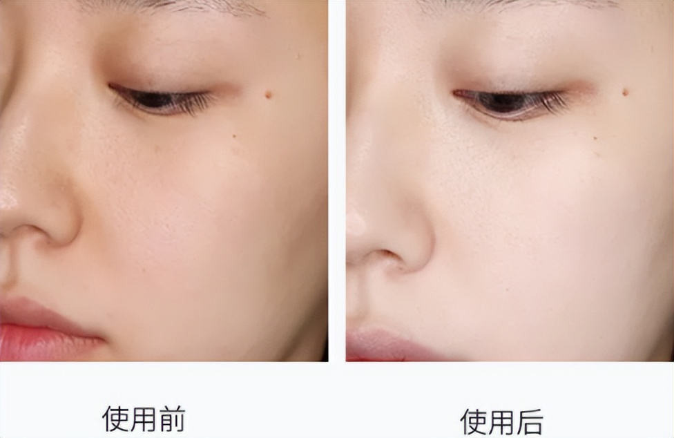 正品新款资生堂悦薇水乳中样套盒,资生堂悦薇水乳2020年双十一