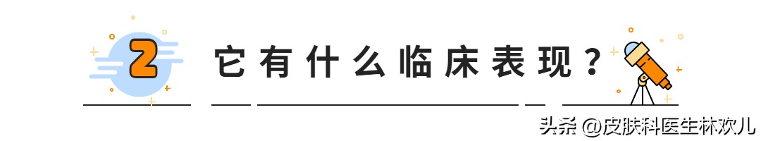 鼻翼两边泛红起皮抹芦荟胶有用吗,鼻翼两侧泛红起皮黄色结痂