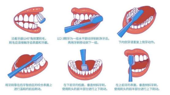 电动牙刷可以预防哪些口腔疾病,电动牙刷对口腔有好处吗