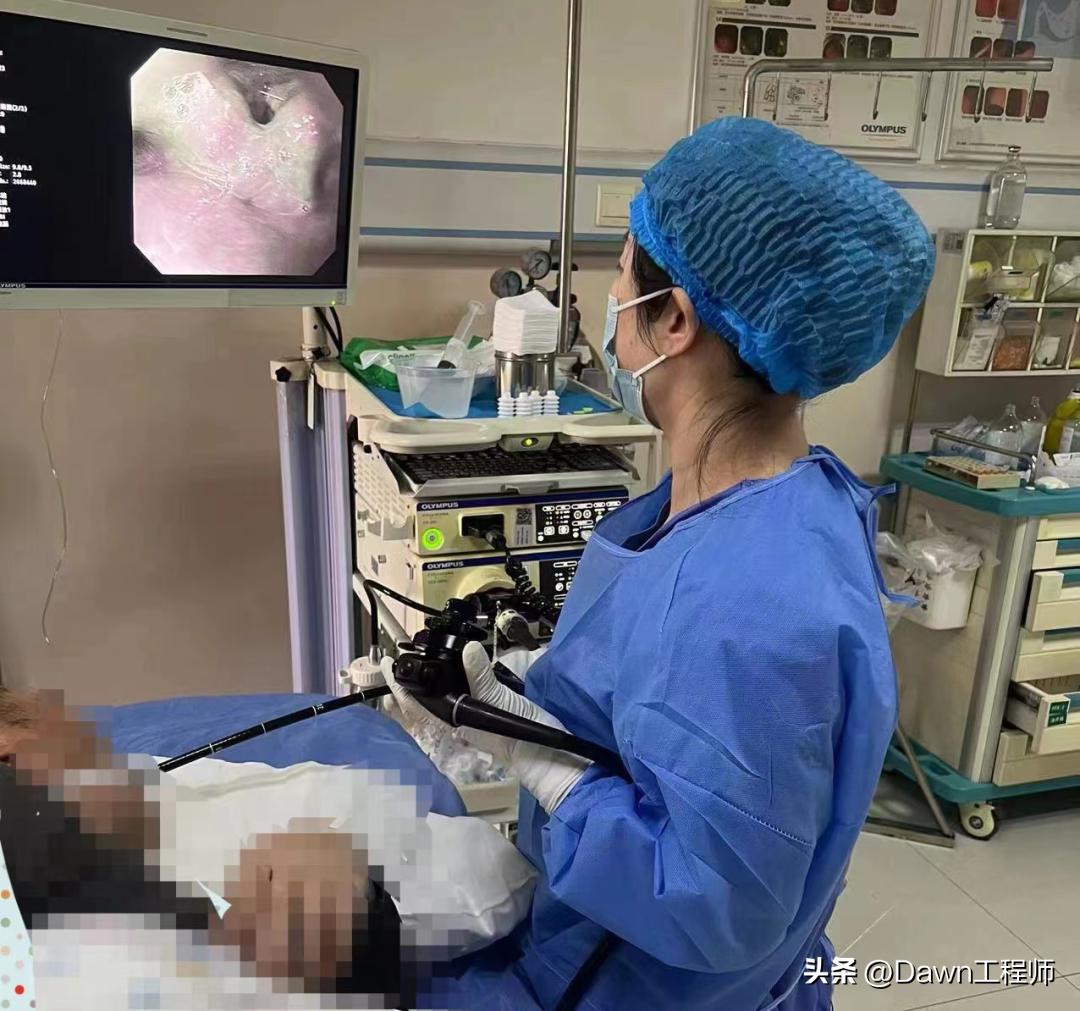 丰县人民医院胃切除手术,食管下段切除肿物手术