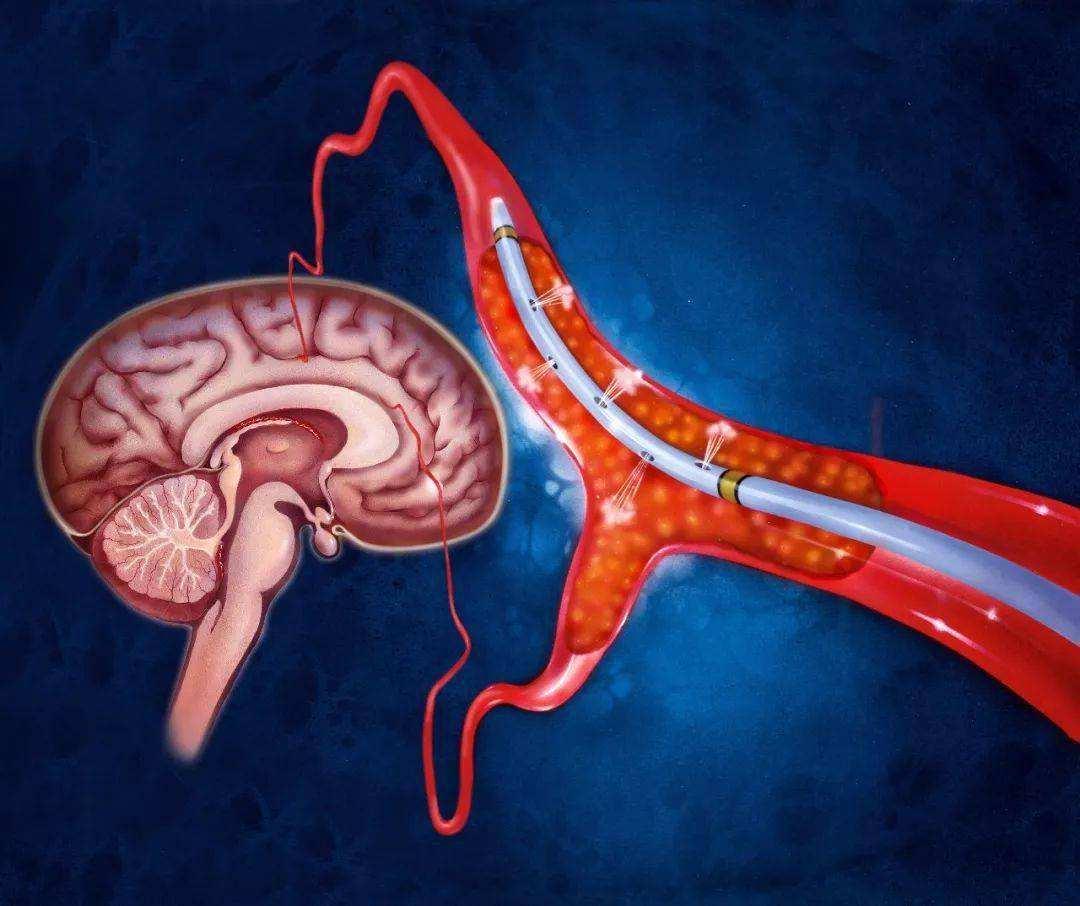 无偿献血后用血为什么这么难,献血科普关于无偿献血7大真相
