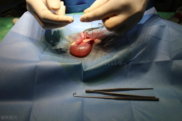 私密位置长小硬块是为什么,私密部分有肿块怎么回事