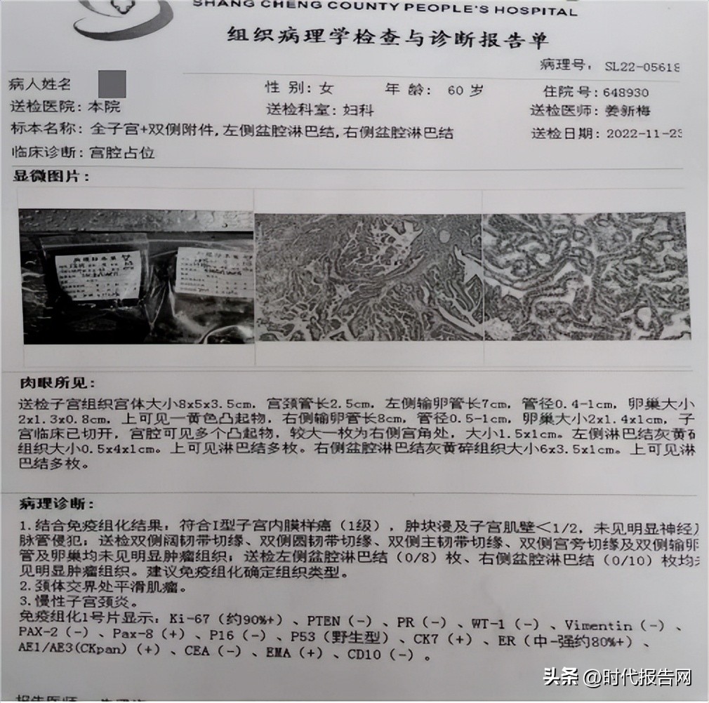 妇科微创手术的新发展,医院完成首例新技术