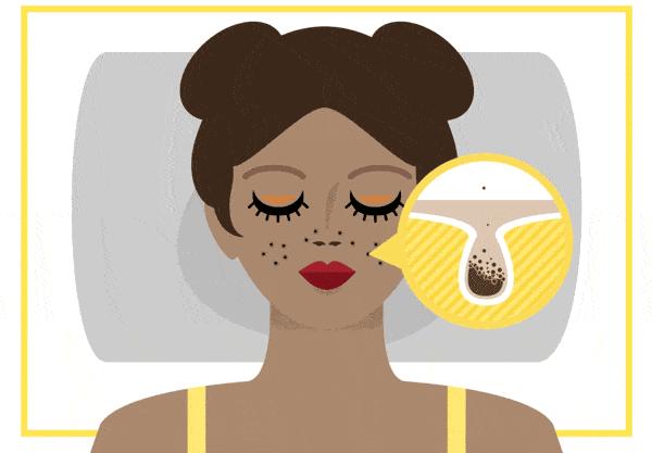 毛孔大到能插秧三招教你缩回去,毛孔粗到可以插秧该怎么自救