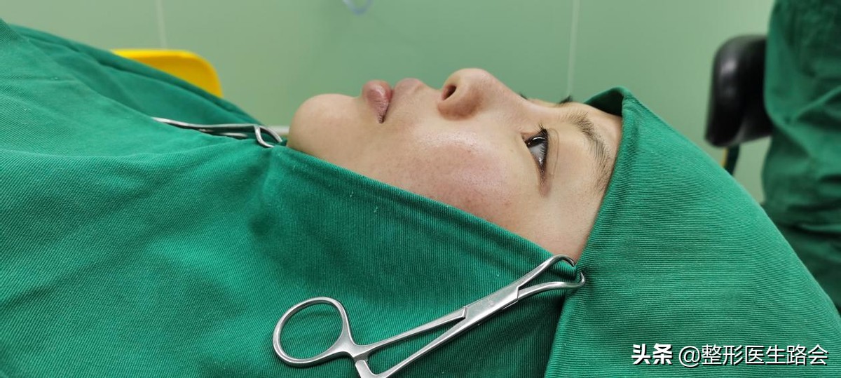 隆鼻失败鼻头有个坑的原因,隆鼻失败导致的鼻头凹陷怎么修复