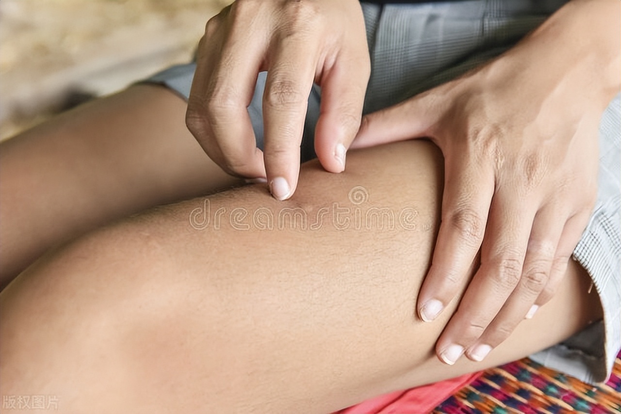 小便之后该用纸擦吗,小便过后用手纸擦可以吗