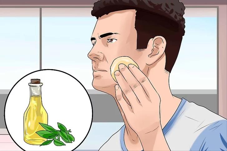 如何有效消灭青春痘小妙招,最有效的方法消灭青春痘