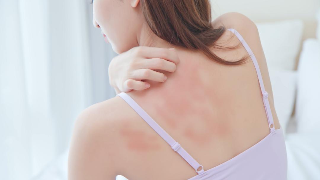 过敏反反复复吃药也没用怎么办,过敏体质反反复复的过敏该怎么办