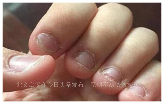 4岁孩子最近总咬指甲咬东西,孩子喜欢咬指甲咬东西