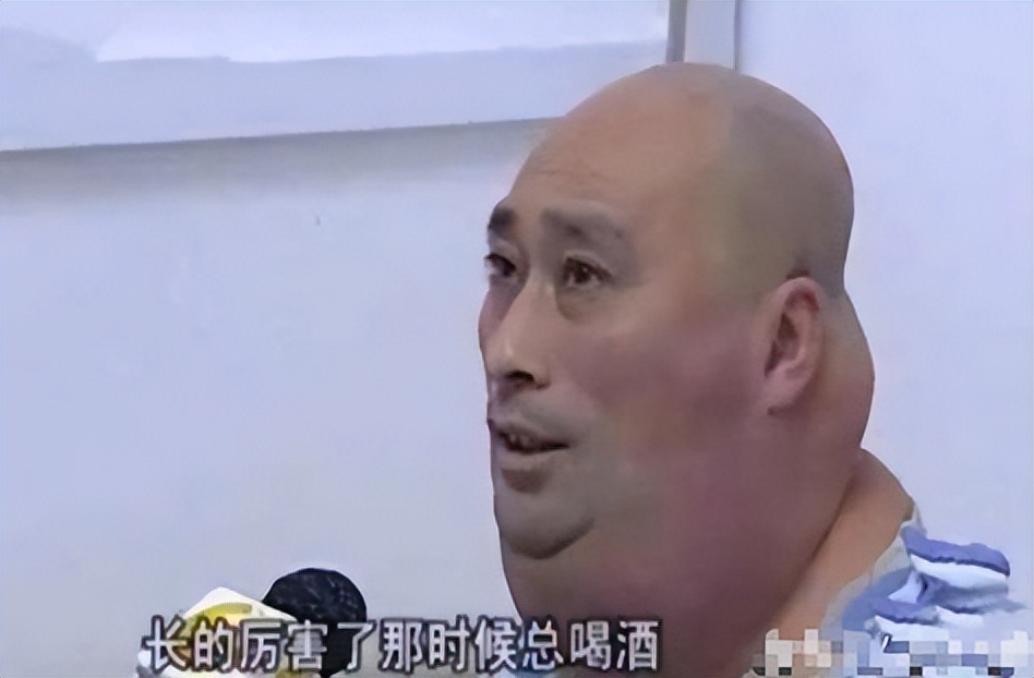 辽宁男子喝3万斤酒撑大脖子,男子嗜酒如命一天三四斤白酒