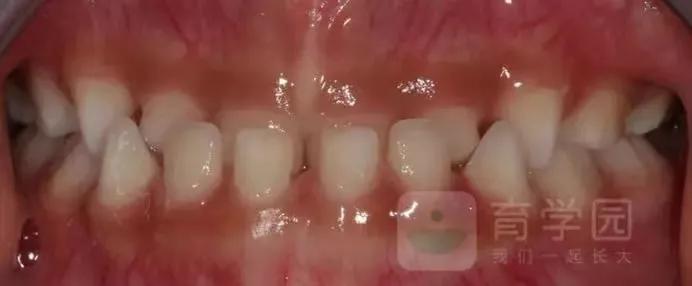 这五个坏习惯真的会让孩子变丑,这些小习惯让你变丑