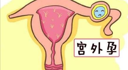 真实事件26岁患癌妈妈舍命生子,乳腺癌真实案例故事