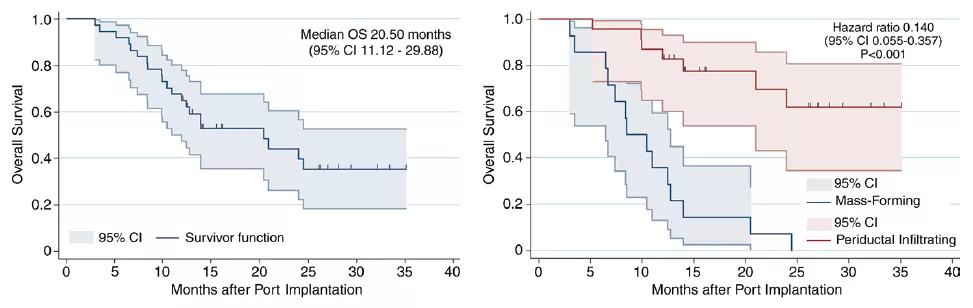 朱旭教授：肝脏介入治疗成为肝脏恶性肿瘤的一种重要治疗手段