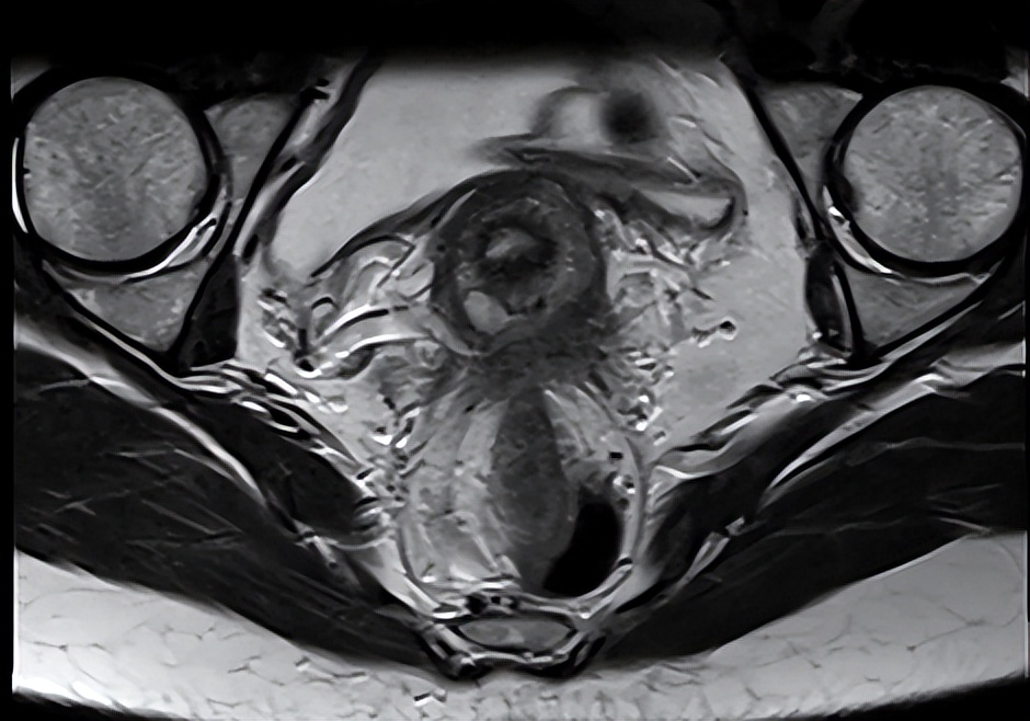 痛经当心您的子宫问题,痛经到底该不该重视