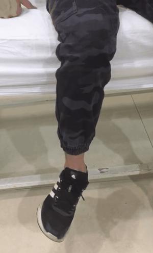 得了脑梗走路脚为什么外翻,脑梗走路提胯脚外翻怎么锻炼