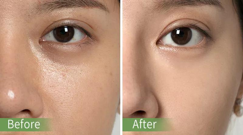 良心推荐敏感肌护肤,夏天好用的洁面推荐哪款