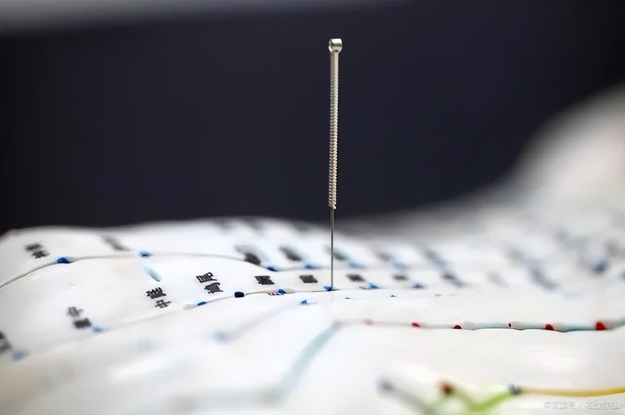 针灸治疗斑秃、乳房胀痛、斑秃、甲状腺结节、贝尔麻痹