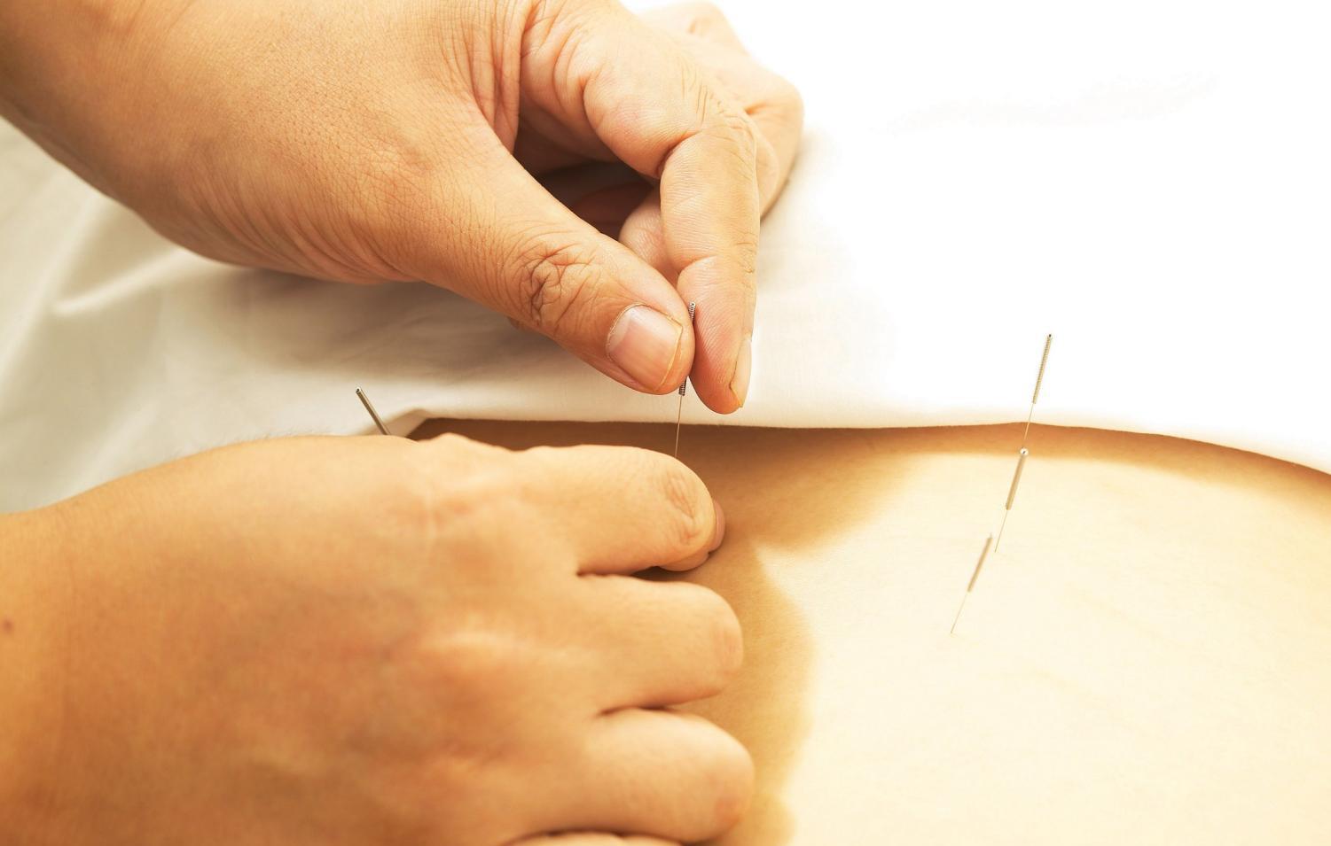 痰瘀阻络中风疏通经络中药方,中医治疗肺炎的临床效果