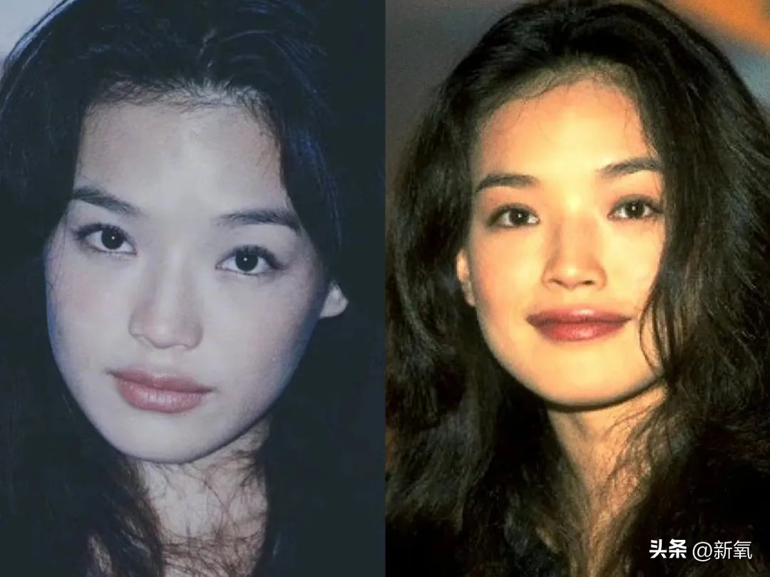 高颅顶怎么掩饰发际线,高颅顶会显得发际线低吗