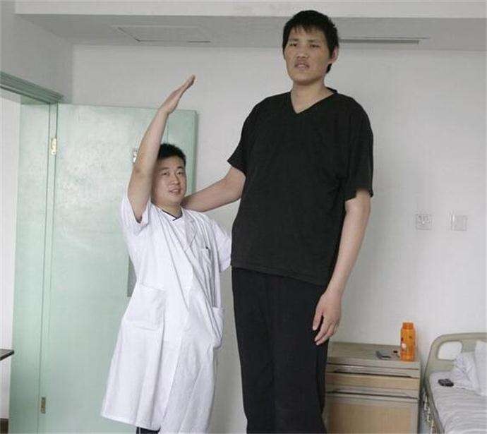 男子身患巨人症身高竟有两米四二,外国夫妇生了巨人症的孩子