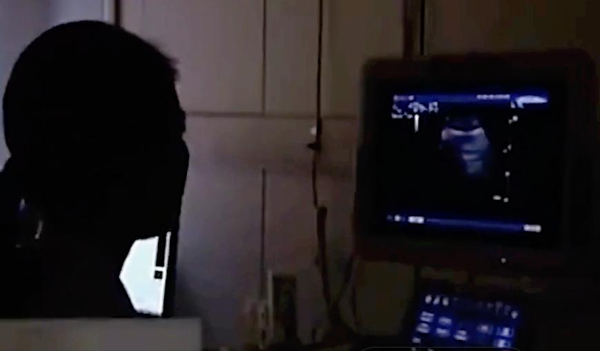 50岁大爷查不出五脏六腑,50岁大爷去体检找不到器官