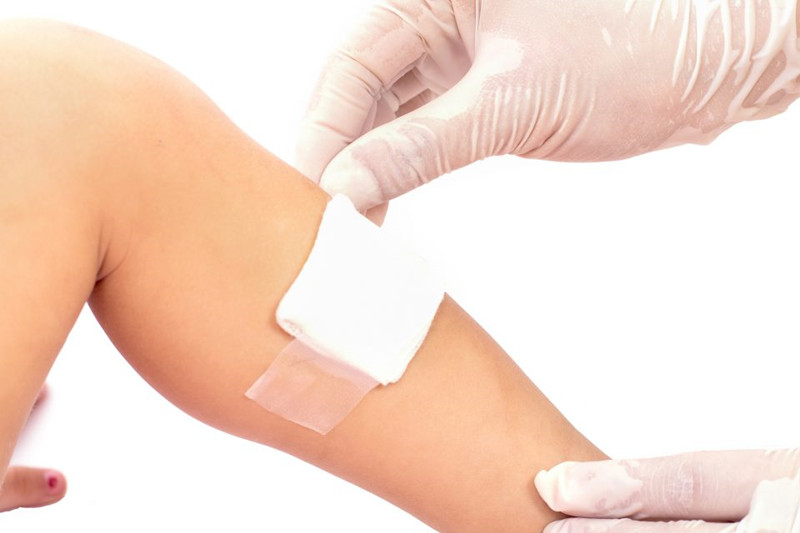 打了石膏如何洗澡,手缝针打了石膏伤口不痛