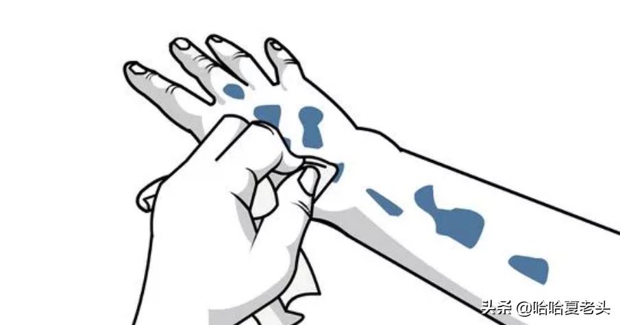 如何洗掉皮肤上染发剂,如何洗掉皮肤上的沥青